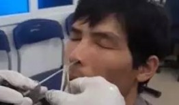医生取出鼻屎的爆料视频,专业手法引网友热议